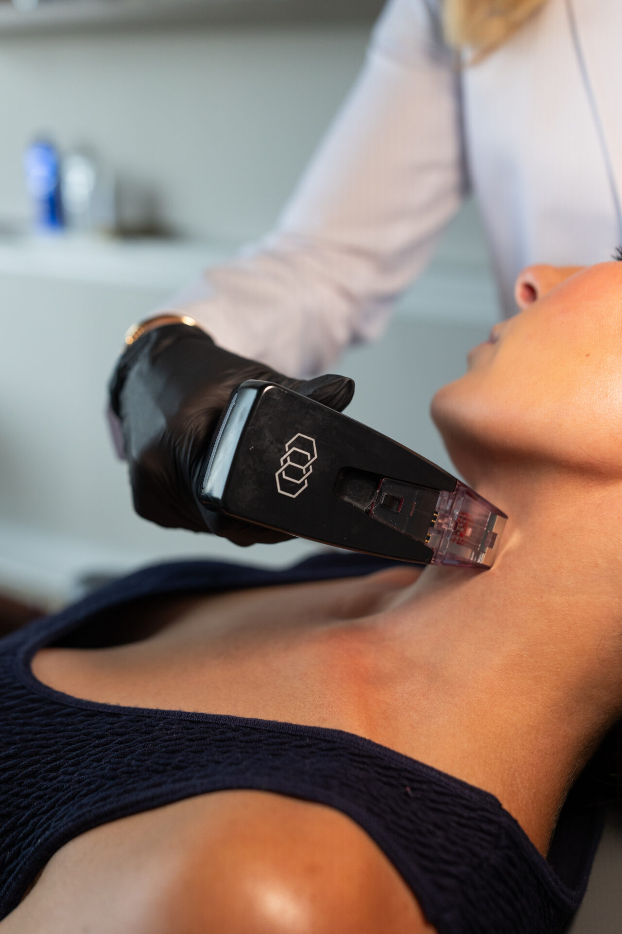 Morpheus8 RF Microneedling Device Morpheus8 handpiece used for fractional radiofrequency microneedling